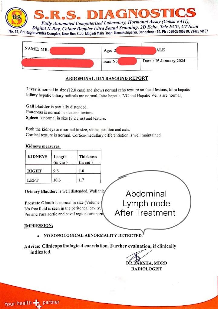 Abdominal Lymph Node After